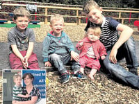 Three-year-old’s rare condition highlighted