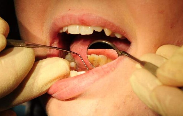 The painful truth about NHS dentistry
