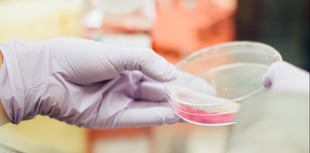Health chiefs supporting Welsh residents linked to hantavirus