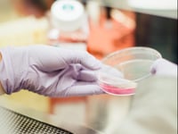 Health chiefs supporting Welsh residents linked to hantavirus