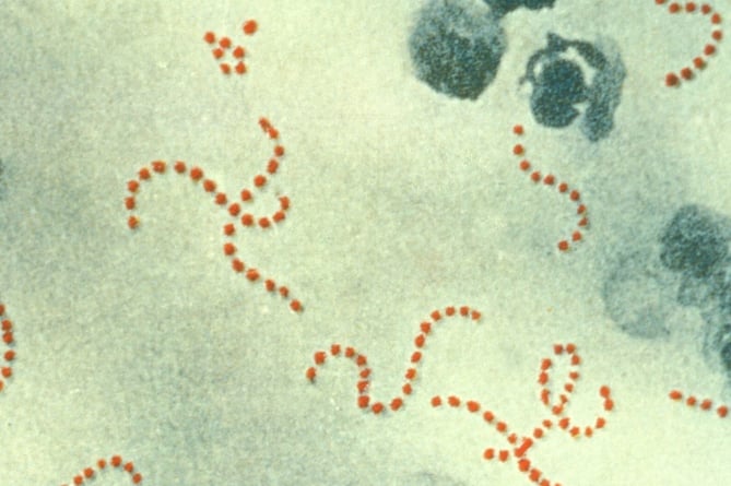 Photomicrograph of Streptococcus pyogenes bacteria
