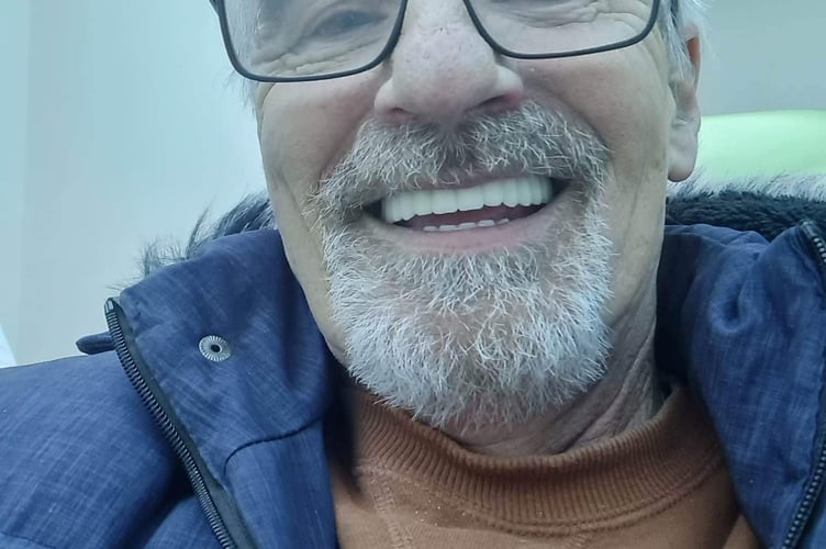 Paul Pilkington teeth after. See SWNS story SWSMteeth - A grandfather looks "ten years younger" after he had 16 teeth pulled out and replaced with implants in Turkey. Paul Pilkington, 70, never showed his teeth when he smiled because he was so self-conscious of his rotting yellow teeth, thanks to 50 years of smoking. The grandfather-of-eighteen quit the habit - but was left him with several missing and rotten teeth. He jetted off to Turkey twice to have his remaining teeth removed and a full set of implants for £7,000. The retired entertainments manager says he "can't stop grinning" whenever he looks in the mirror - and people say he looks ten years younger. Paul, originally from Bolton Lancs., said: "I worked in entertainment all my life and was always self-conscious being in front of people every day.
