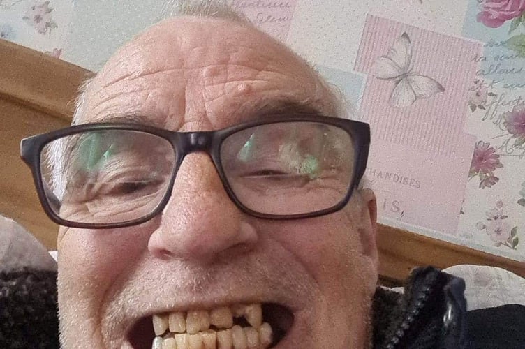 Paul Pilkington Teeth before. See SWNS story SWSMteeth - A grandfather looks "ten years younger" after he had 16 teeth pulled out and replaced with implants in Turkey. Paul Pilkington, 70, never showed his teeth when he smiled because he was so self-conscious of his rotting yellow teeth, thanks to 50 years of smoking. The grandfather-of-eighteen quit the habit - but was left him with several missing and rotten teeth. He jetted off to Turkey twice to have his remaining teeth removed and a full set of implants for £7,000. The retired entertainments manager says he "can't stop grinning" whenever he looks in the mirror - and people say he looks ten years younger. Paul, originally from Bolton Lancs., said: "I worked in entertainment all my life and was always self-conscious being in front of people every day.