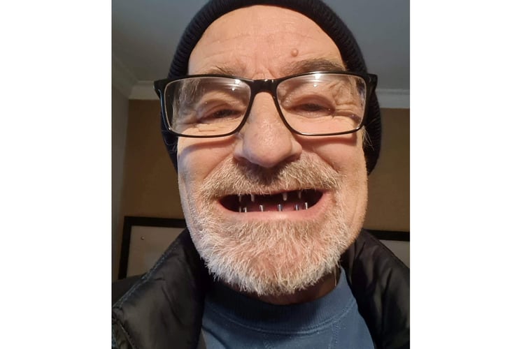 Paul Pilkington teeth