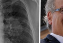 Early diagnosis test for lung cancer will save lives