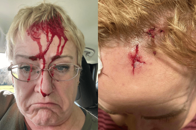 Cllr Louise Hughes slipped and fell, injuring her head