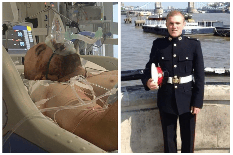 Sean (left) in Stoke Hospital after the crash, (right) as a marine