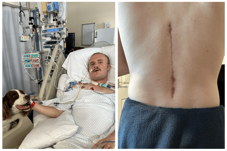 Sean (left) with hospital therapy dog Kevin, (right) Sean's scar from his spinal surgery