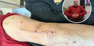 Dyfi mountain biker suffers catastrophic injuries from "simple fall"