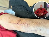 Dyfi mountain biker suffers catastrophic injuries from "simple fall"