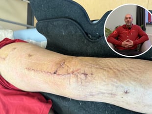 Dyfi mountain biker suffers catastrophic injuries from "simple fall"