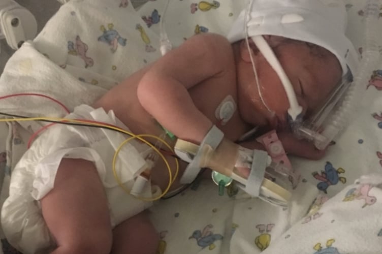 Cala-Mai was born six weeks premature