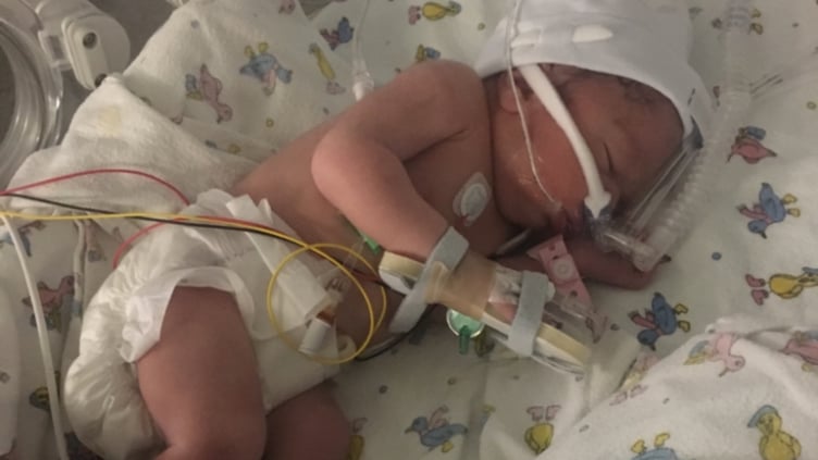 Cala-Mai was born six weeks premature