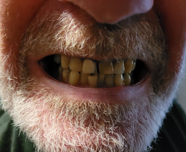 Teething pains: Superglue, pliers and years of tears