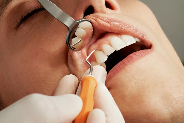 Dental service recruitment drive underway