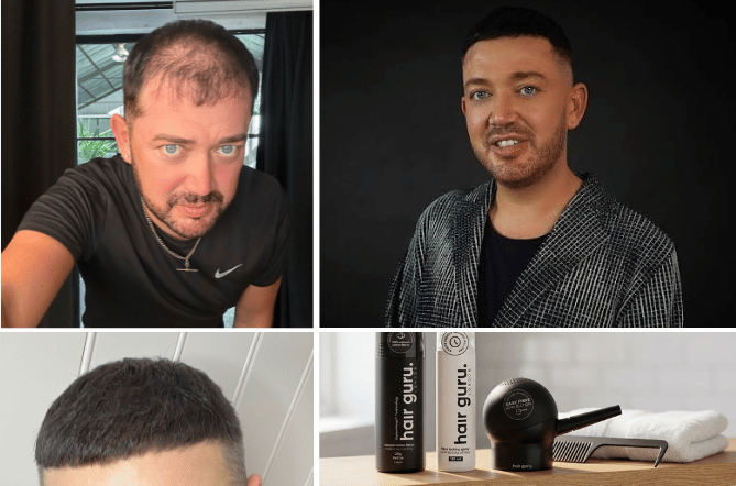 Clockwise from top left: Jamie Shepherd before using his products, now, his Hair Guru London items and after using them